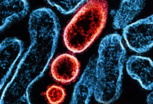 破除尼帕病毒恐慌：为什么很多“新病毒”其实不必担心？