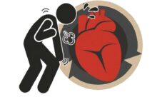 40岁以后，如何预防心源性猝死？